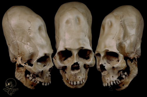 Black Market Online - Human Skull Replicas image